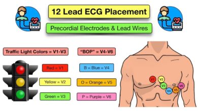 leads on ecg